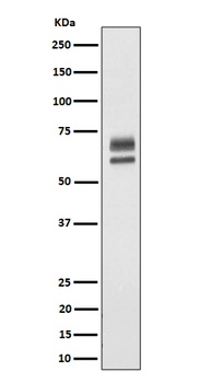 PPP2R5D Rabbit Monoclonal Antibody
