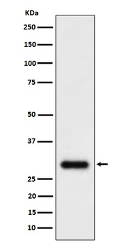 TMEM192 Rabbit Monoclonal Antibody