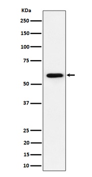 PRPF31 Rabbit Monoclonal Antibody