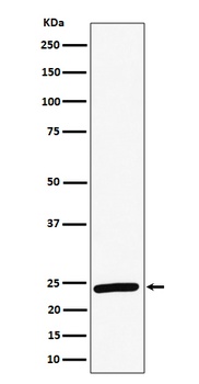 RAB8A Rabbit Monoclonal Antibody