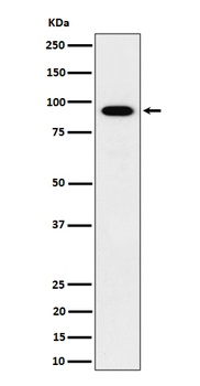 IFT88 Rabbit Monoclonal Antibody