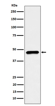 CECR5 Rabbit Monoclonal Antibody