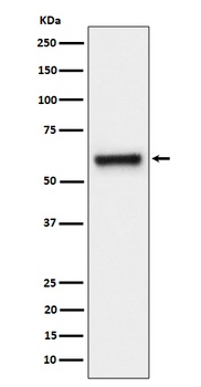 FPGS Rabbit Monoclonal Antibody