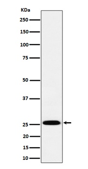 TEMT Rabbit Monoclonal Antibody