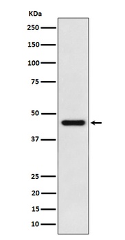 ACAT1 Rabbit Monoclonal Antibody