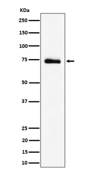 RAVER2 Rabbit Monoclonal Antibody
