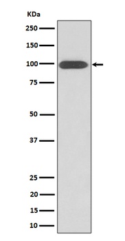 Integrin beta 3/CD61 Rabbit Monoclonal Antibody