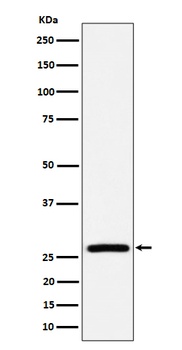 AK2 Rabbit Monoclonal Antibody