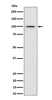 Phospho-MDM2/MDM2 Rabbit Monoclonal Antibody