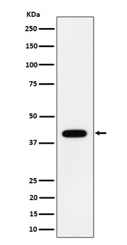 ACADS/SCAD Rabbit Monoclonal Antibody