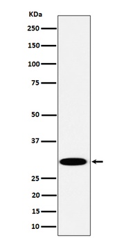 TPMT Rabbit Monoclonal Antibody