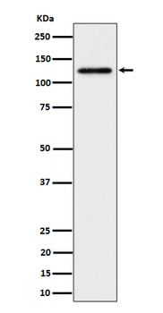 SPINK5/LEKTI Rabbit Monoclonal Antibody
