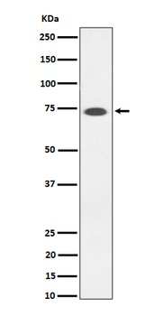 SSTR3 Rabbit Monoclonal Antibody