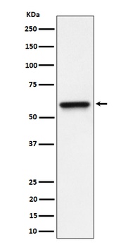 RGS6 Rabbit Monoclonal Antibody