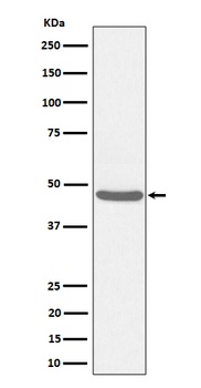 BCKDK Rabbit Monoclonal Antibody