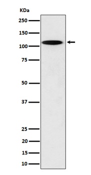 N4BP1 Rabbit Monoclonal Antibody