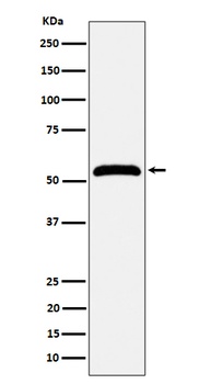 MPP1 Rabbit Monoclonal Antibody