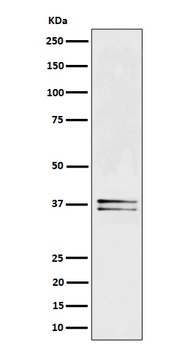 LAT Rabbit Monoclonal Antibody