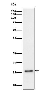 TRAPPC2 Rabbit Monoclonal Antibody