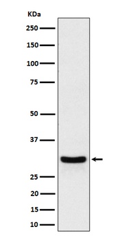 FRAT1 Rabbit Monoclonal Antibody