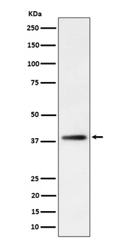 FDPS Rabbit Monoclonal Antibody
