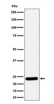 RAB5C/RABL Rabbit Monoclonal Antibody