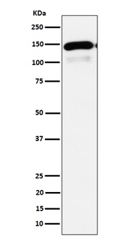 PLCB1 Rabbit Monoclonal Antibody