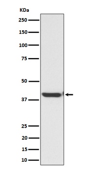 ENDOGL1/ENGL Rabbit Monoclonal Antibody