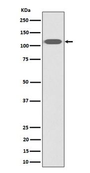 ZHX2 Rabbit Monoclonal Antibody