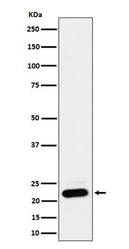 NDUFB9 Rabbit Monoclonal Antibody