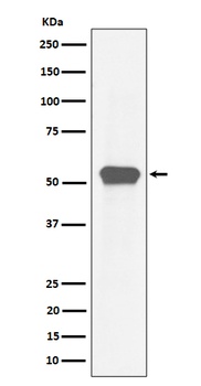 MEF2A Rabbit Monoclonal Antibody