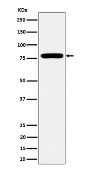 GFPT1 Rabbit Monoclonal Antibody
