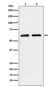 CLPX Rabbit Monoclonal Antibody