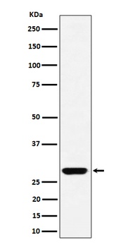 GCLM Rabbit Monoclonal Antibody