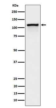 Phospho-CBL/CBL Rabbit Monoclonal Antibody