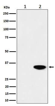 Phospho-Nucleophosmin Rabbit Monoclonal Antibody