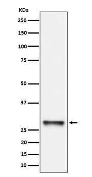 PNMT Rabbit Monoclonal Antibody