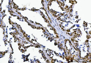 SPT5/SUPT5H Rabbit Polyclonal Antibody