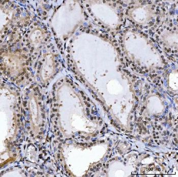 SPT5/SUPT5H Rabbit Polyclonal Antibody