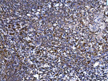 SPT5/SUPT5H Rabbit Polyclonal Antibody