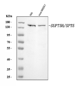 SPT5/SUPT5H Rabbit Polyclonal Antibody