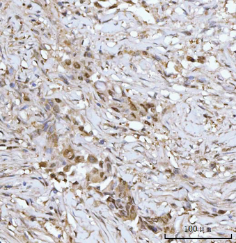 PRMT5 Rabbit Polyclonal Antibody
