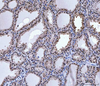 PRMT5 Rabbit Polyclonal Antibody