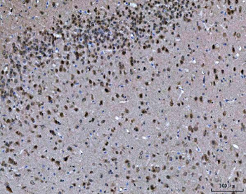 PRMT5 Rabbit Polyclonal Antibody