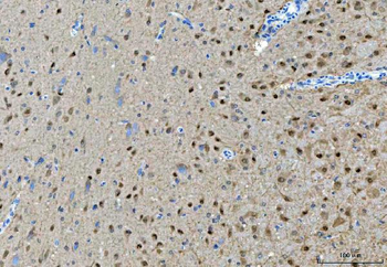 PRMT5 Rabbit Polyclonal Antibody