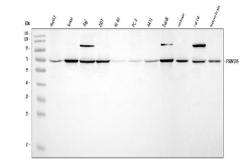 PRMT5 Rabbit Polyclonal Antibody