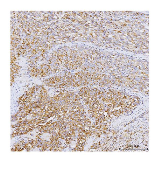 GADD34/PPP1R15A Rabbit Polyclonal Antibody