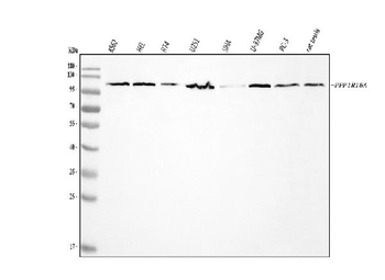 GADD34/PPP1R15A Rabbit Polyclonal Antibody