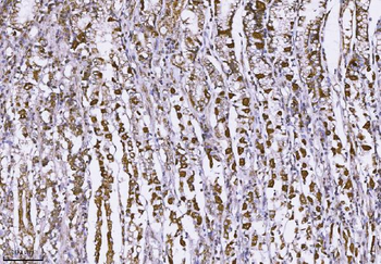 MUC2 Rabbit Polyclonal Antibody