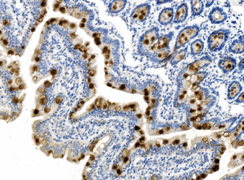 MUC2 Rabbit Polyclonal Antibody